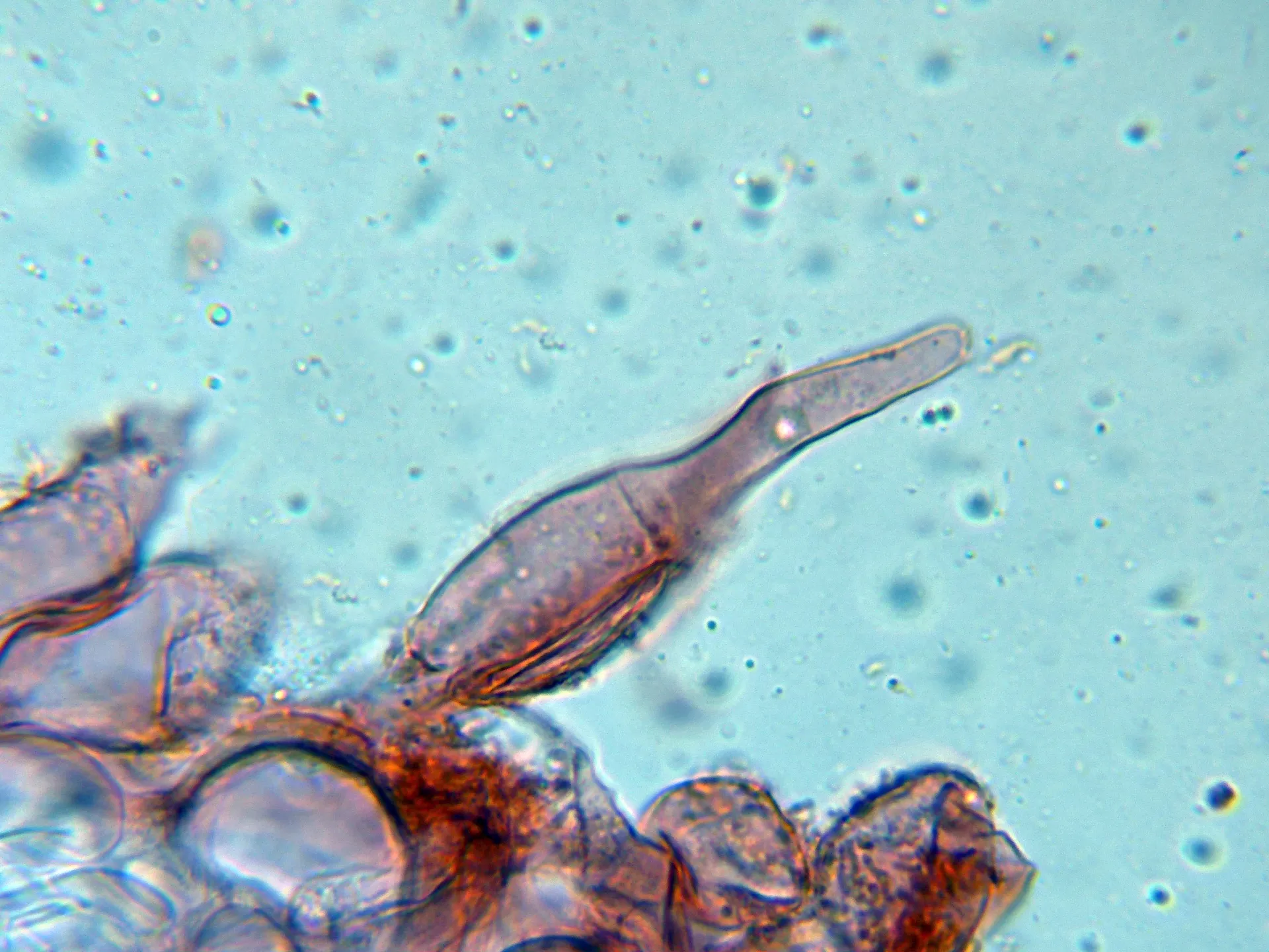 Microscopía de Mycena niveipes - 10 - Queilocistidio-001
